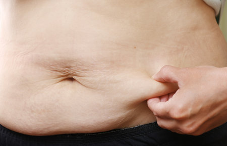 Close up of mother womans belly showing stretch mark loose lower abdomen skin she fat after pregnancy baby birth, studio isolated on white background, Healthy belly overweight excess body concept.の写真素材