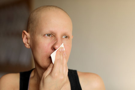 Bald cancer sick woman blowing running nose got flu cough cold, rhinitis sneezing in tissue or nosebleeds. Female is sick allergic having allergy symptoms coughing holding napkin. Misery, infelicity.の写真素材