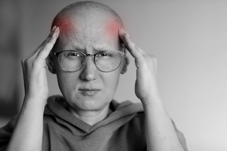 Hairless woman in glasses touching head with hands, suffering from headache after chemotherapy. Unhappy bald cancer sick female patient having migraine at home. oncology concept. healthcare, medicine.の写真素材