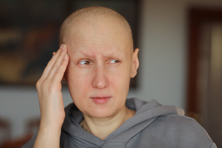 Bald woman touching head with fingers, suffering from headache after chemotherapy. Unhappy hairless cancer sick female having migraine at home. Oncology concept. Healthcare,medicine.の写真素材