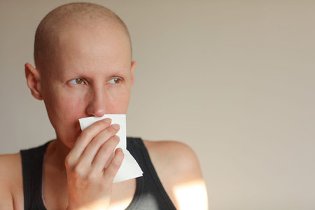 Bald cancer sick woman blowing running nose got flu cough cold, rhinitis sneezing in tissue or...