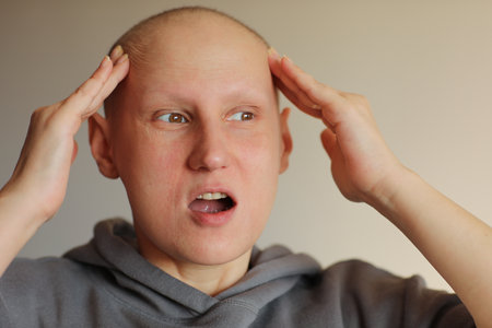 Bald woman touching head with fingers, suffering from headache after chemotherapy. Unhappy hairless cancer sick female having migraine at home. oncology concept. healthcare, medicine.の写真素材