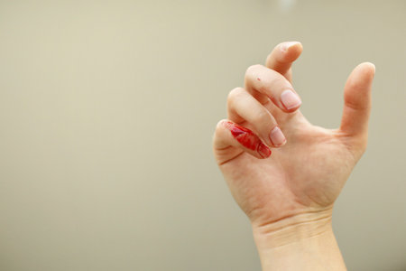 Female hand with red blood, little finger is bleeding profusely. Woman injured her little finger at home with knife or other sharp object. Bleeding wound and body injury result. domestic accidentの写真素材