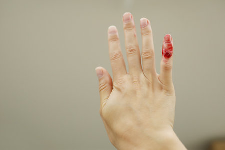 Female hand with red blood, little finger is bleeding profusely. Woman injured her little finger at home with knife or other sharp object. Bleeding wound and body injury result. domestic accidentの写真素材