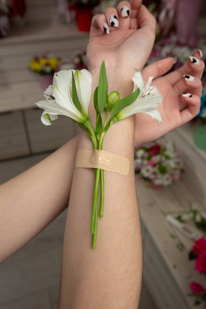 Alstroemeria attached to a hand with plaster bands. Natural freshness and woman hand. Hands cosmetics with white flower adhesive plaster. Concept-natural therapyの写真素材