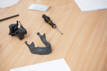 Dental model on the table close-up. 3d dental model on the table. Dental model with mini screw....