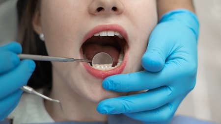 Close-up of an open female mouth. The dentists mirror reflects the lower teeth. Doctor appointment and caries prevention concepの写真素材