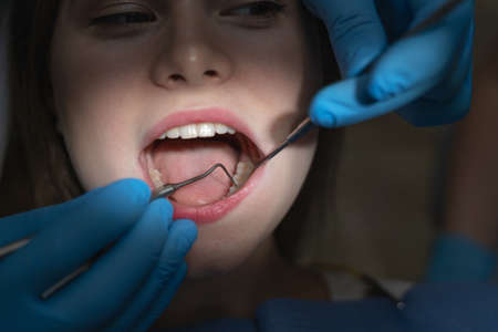 close-up of an open female mouth in bright light in a dark dentist office.の写真素材