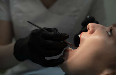 Close-up examination of the patients oral cavity by the dentist in black medical gloves with instruments. Dental treatment and prosthetics.の写真素材
