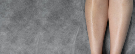 Image before and after concept of hair removal on female legs in a beauty salon. Baner.