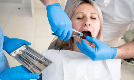 girls mouth in the bib of the patient in the dental clinic. A dentist in blue latex gloves removes her tooth with a buccal retractor and forceps.の写真素材