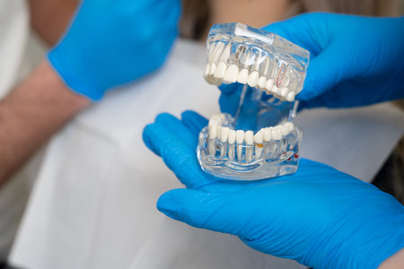 dentist implantologist shows a patient a jaw with implants and veneer crowns, implantology in...