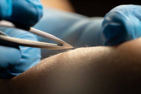 Removing unwanted hair on the legs with tweezers, process of epilation in beauty salonの写真素材