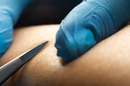 close-up detail of woman using pair of tweezers, removing hair from leg in a beauty salon.の写真素材