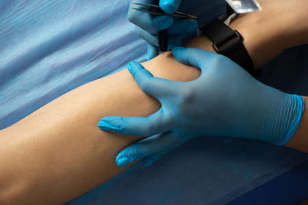 Woman with leg hair removal in beauty clinic, electrolysis.の写真素材