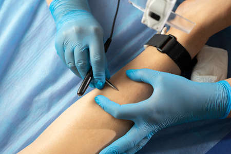 Woman with leg hair removal in beauty clinic, close-upの写真素材
