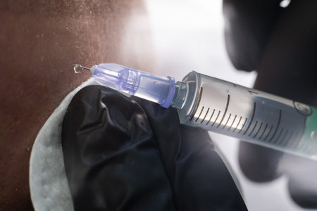 Close-up of a mature man receiving hair loss treatment injections into the scalp by a trichologist....