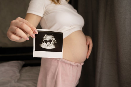 Pregnant woman demonstrating her ultrasound photo while standing at bedroom. Picture with ultrasound scan resultの写真素材