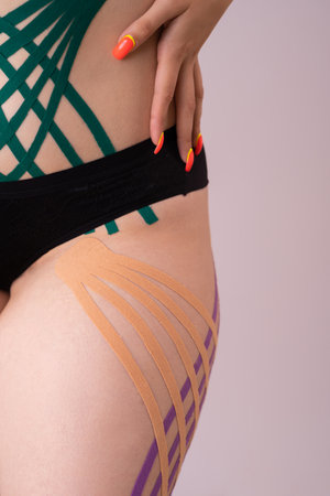 applying physio tape to female patient legs.physio taping. Anti-cellulite procedure for slim hips.Fat lose, cellulite removal. Weight lossの写真素材