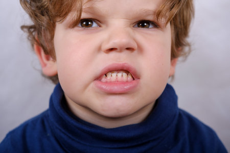 malocclusion of the boy close up. medical problem