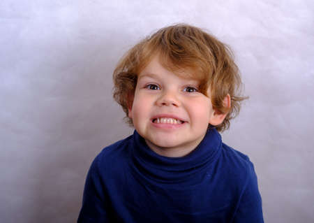 malocclusion of the boy close up. medical problemの写真素材