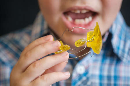 the boy puts a Frenkel device in his mouth to correct the bite. Medicine, orthodontics. Correction of bite in children.の写真素材