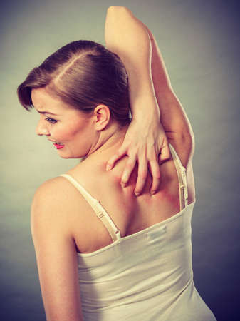 Health problem, skin diseases. Young woman scratching her itchy back with allergy rashの写真素材