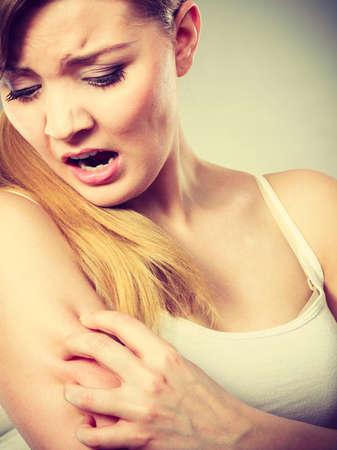Health problem, skin diseases. Young woman scratching her itchy arm with allergy rashの写真素材