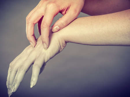 Dermatology, allergy and health problem. Young female scratching her itchy palm with allergy rashの写真素材