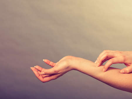 Dermatology, allergy and health problem. Young female scratching her itchy arm with allergy rashの写真素材