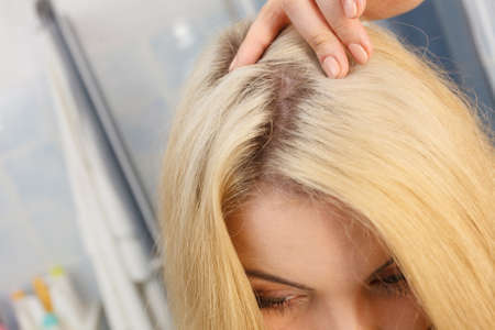 Woman showing her hair regrowth roots after blonde dying. Close up of female head.の写真素材