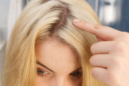 Woman showing her hair regrowth roots after blonde dying. Close up of female head.の写真素材