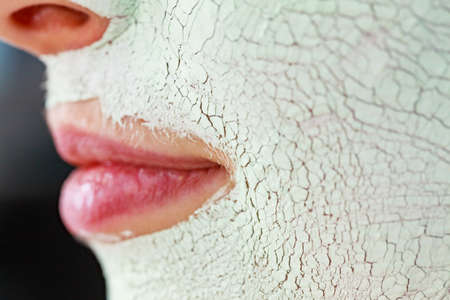 Close up woman with green white mud mask on face, detail view. Teen girl have dry cracked cosmetic on skin. Beauty treatment. Skincare.の写真素材