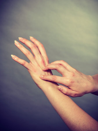Dermatology, allergy and health problem. Young female scratching her itchy palm with allergy rash