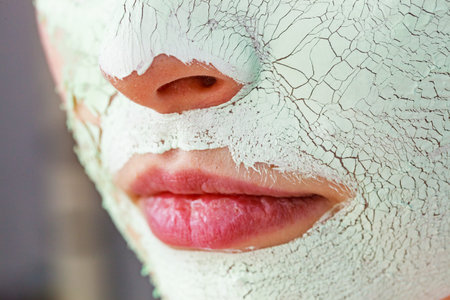 Close up woman with green white mud mask on face, detail view. Teen girl have dry cracked cosmetic...