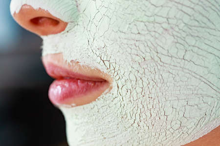 Close up woman with green white mud mask on face, detail view. Teen girl have dry cracked cosmetic on skin. Beauty treatment. Skincare.の写真素材