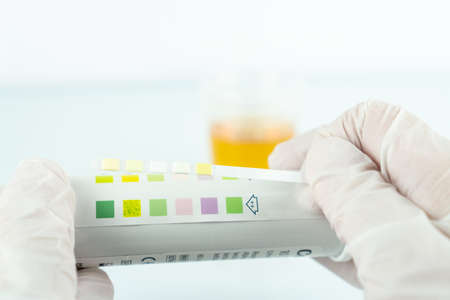 Check up, routine urinalysis, reagent strip for urinalysisの写真素材
