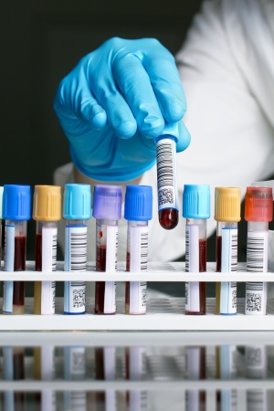 A laboratory technician removing a tube rack with a blood sample labeled with bar code on a black backgroundの写真素材