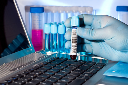 hand holding a tube of blood to record data at a computerの写真素材