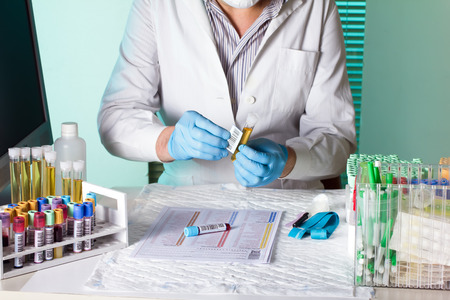 laboratory technician holding and labeling sample tubes urine and blood for coding traceability