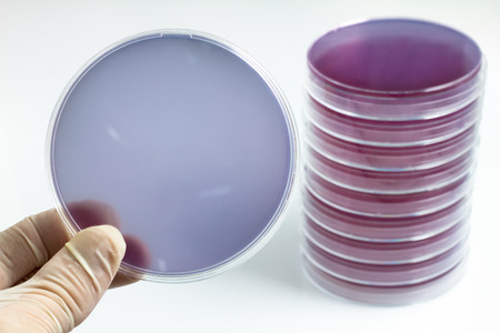 hand of microbiologist holding petri dish in the background white / scientist holding a petri dish