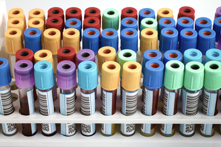 Tubes with bar code for analysis of blood samples in the hospital table  rack of blood tubes labeled in blood bank lab