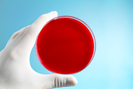 hand of a lab researcher holding prepared media dish in microbiology laboratory  hand holding petri...