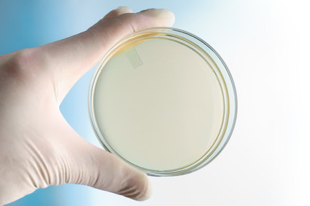 hand of microbiologist holding petri plate at background blue and white  scientist with hand holding petri dishの写真素材