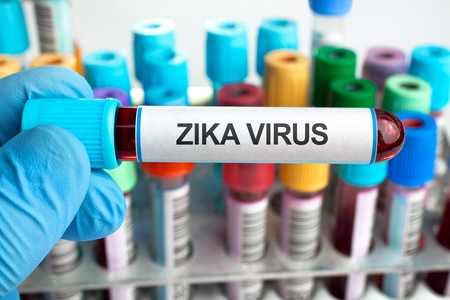 hand holding a tube labeled with the words pika virus and in the background a rack with other tests  Blood tests with text zika virusの写真素材