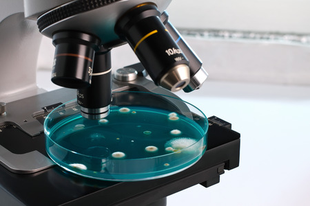 petri plate in micro on workbench of lab / petri dish in the laboratory microscope