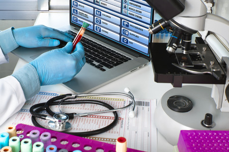 doctor testing blood tube in the laboratory / hands of a scientist holding blood tube sample in hematology labの写真素材