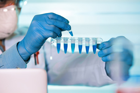 scientist holding tube and working with laptop at genetic lab / hands of biomedical engineering...