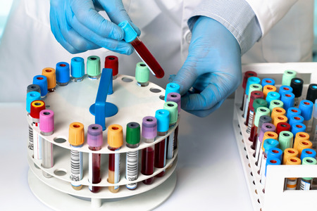 blood tubes samples in tray / hands holding blood tube and rack in the analysis laboratory
