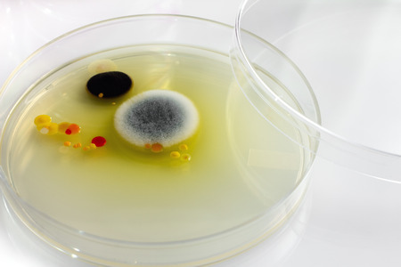 Fungi on agar Sabouraud plate in the laboratory / Fungi on petri dishの写真素材